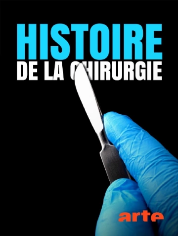 Histoire de la chirurgie